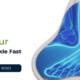 Heal Your Sprained Ankle Fast